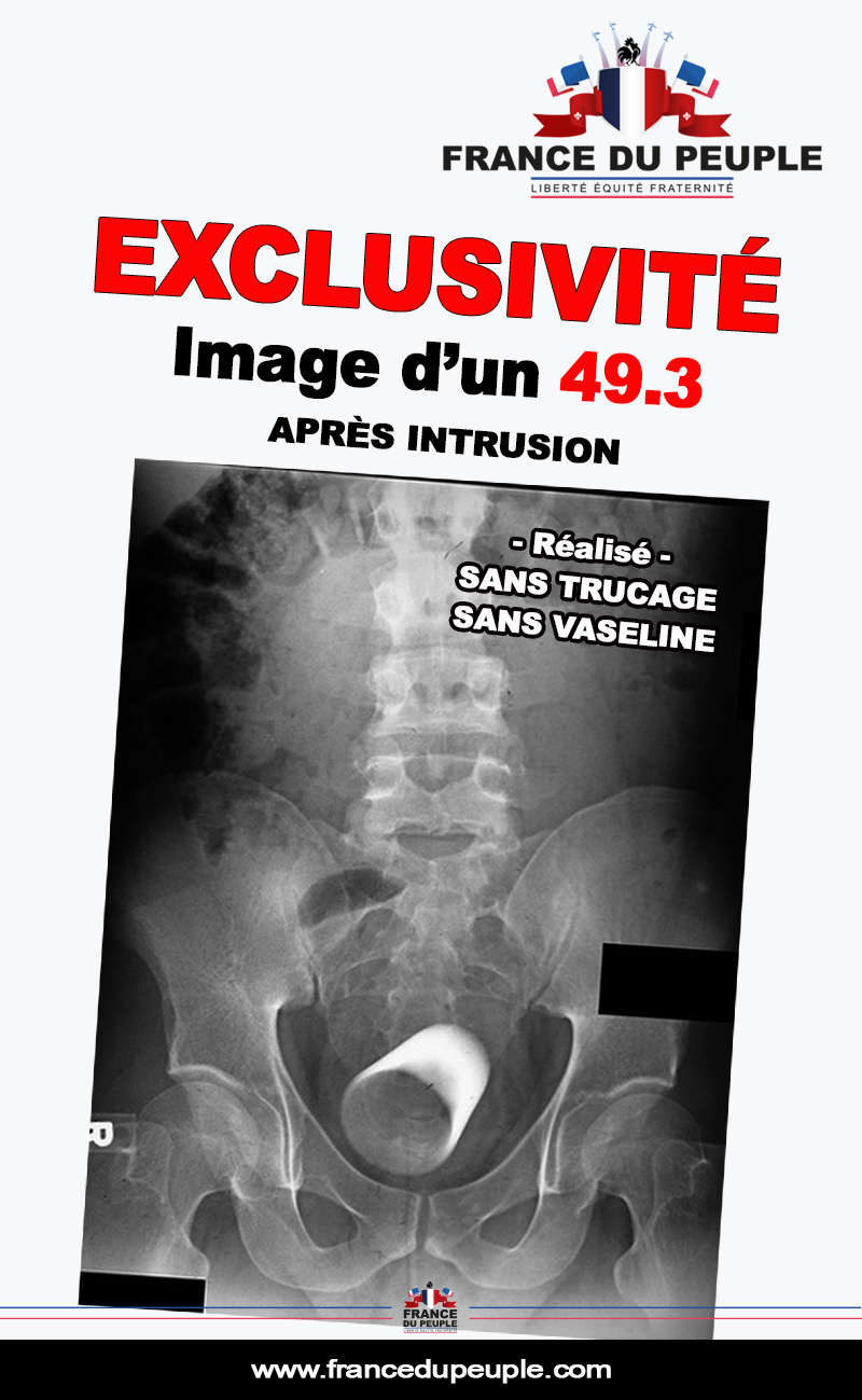 Alerte Intrusion493